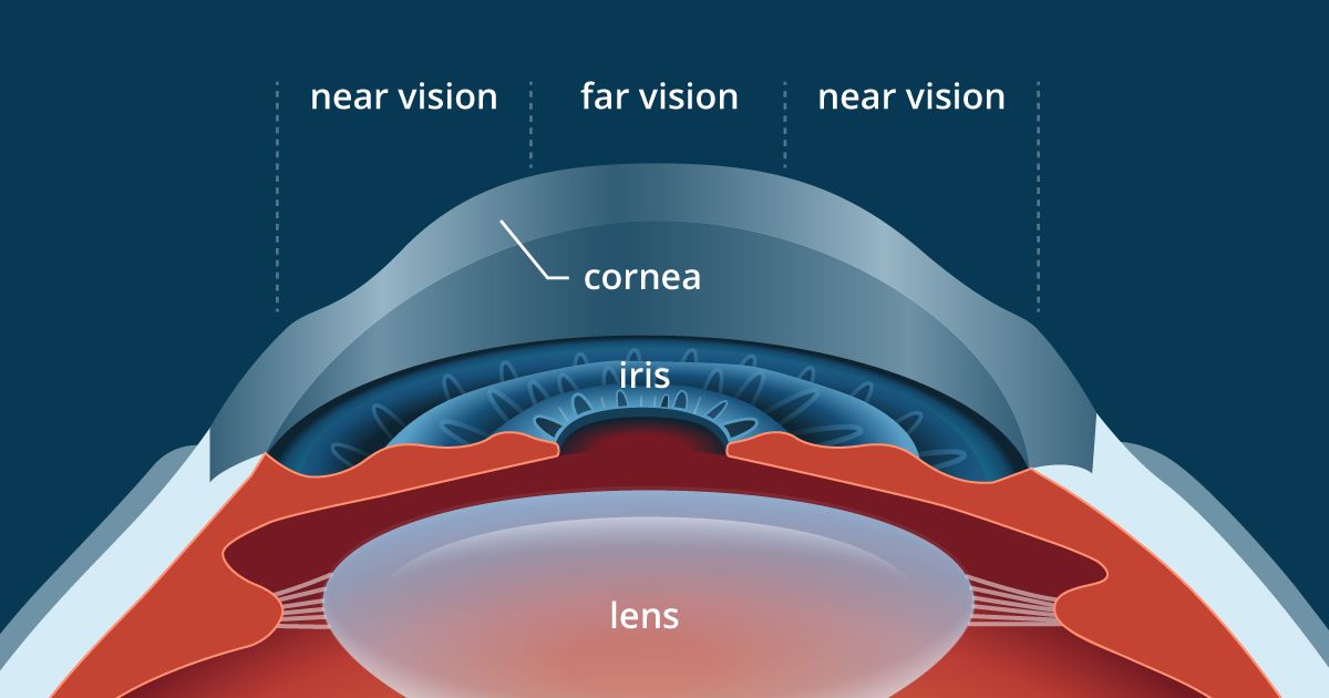 eye exam for reading glasses