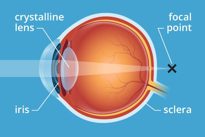 presbyopia and eye exams for reading glasses